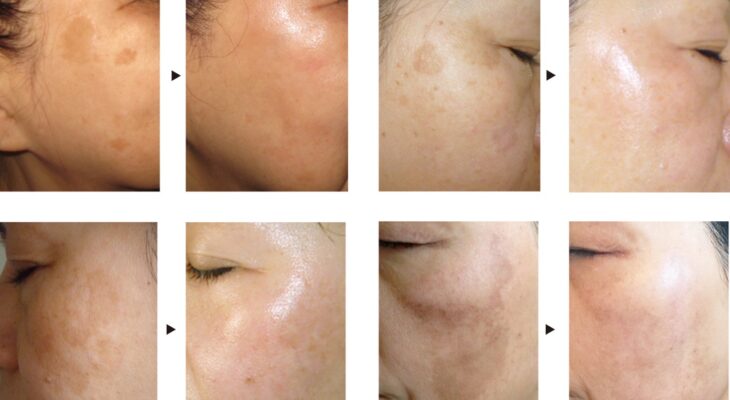 美容クリニックに行く前に　part3