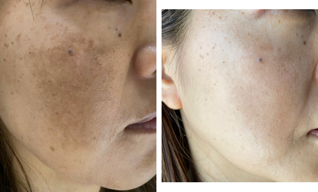 美容クリニックに行く前に①